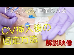 CV挿入後の固定方法について － 解説映像｜提供：東京北医療センター