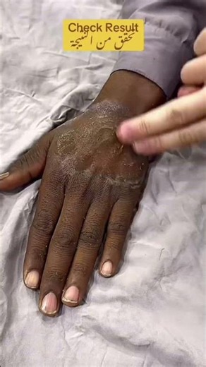 Deep Cleansing Remove Dust and Dead Skin #ameenbeautytips ‪@GlowAndCleanByAmeen‬