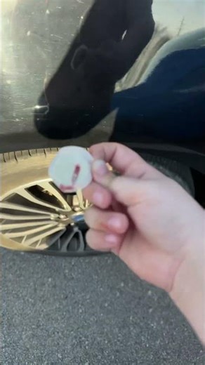 Dexcom injection failure ￼