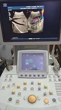 Philips iU22 Ultrasound Machine +92 320 9531247