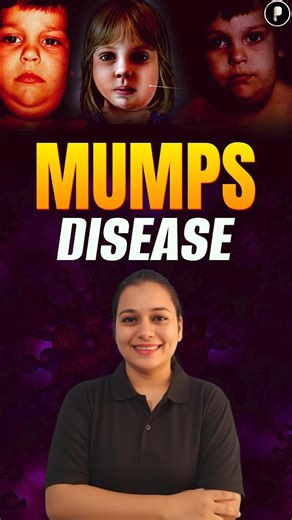 Mumps Disease: Symptoms, Causes & Prevention 🧬