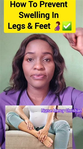 How To Prevent Swelling In Legs And Feet During Pregnancy 🤰 #pregnancy #baby | Nurse Mercy Christian
