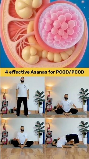 4 Best Yoga Asanas for PCOD/PCOS | Balance Hormones Naturally