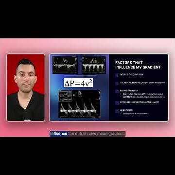 Mean Gradient in Mitral Stenosis: Doppler Tips and Pitfalls
