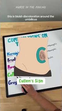 5 clinical signs that will DEFINITELY show up on the NCLEX 🩺