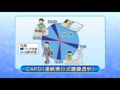 腹膜透析（CAPD）