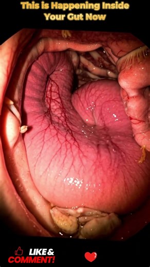 Inside Your Gut: The Digestive System at Microscopic Level | 15