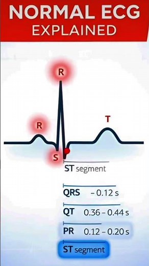 Así se ve un EKG normal | Lo que debes reconocer en un electrocardiograma