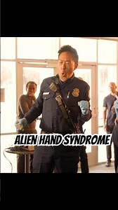 Alien Hand Syndrome.#foryou #shorts #shortvideos #shortvideo