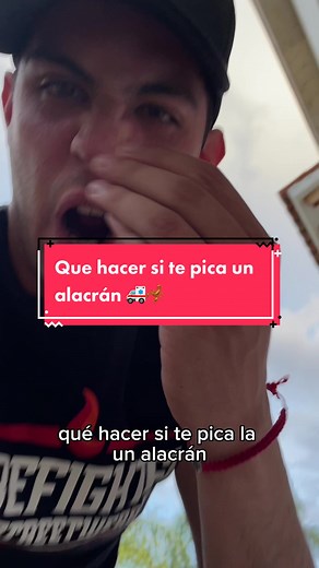 Qué hacer si te pica un alacrán: primeros auxilios