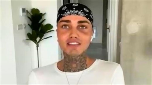 TikToker Levi Jed Murphy Shares Plans For MORE Surgery