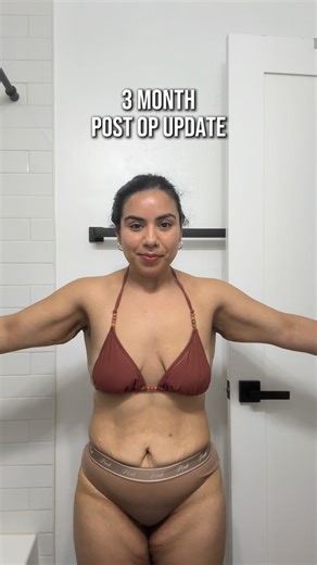 Eliuth Lopez •Weight Loss Coach on Instagram: "3 months post op! This whole journey has been all about being patience and kind to myself as I’m learning to love my body through its changes! As more days go by and as I continue to heal I fall in love even more! 😭❤️ I did an arm & breast lift, breast augmentation and a lateral chest incision! I went to @dr.perezplasticsurgery at @marinaplasticsurgery ! If you’d like to book a free consultation with Dr. P at Marina Plastic Surgery, the 🔗 is in my