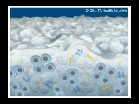 FORTIGEL® Animation