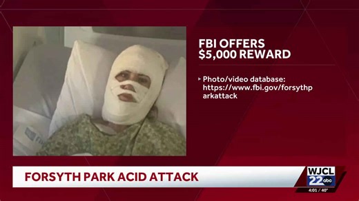 Reward offered after woman attacked at Savannah's Forsyth Park