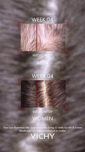 NEW Dercos Aminexil Clinical R.E.G.E.N. Booster | Vichy Laboratoires