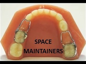 Band & loop Space Maintainer Soldering Application