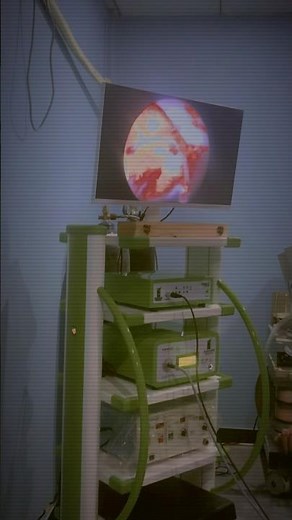 TURP SURGERY Bladder operation” or “Urinary surgery.”#urinerybladder#shorts #medicaleducation