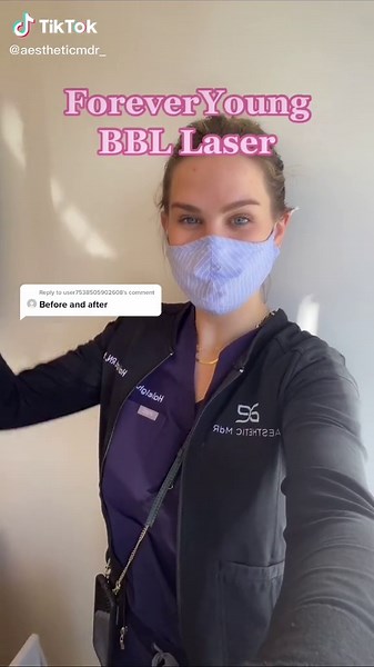 BBL Laser Before and After Transformation