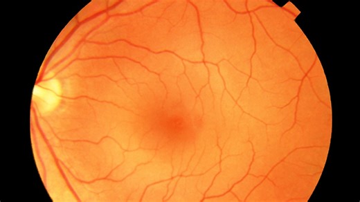 The brain - Coordination and control - The nervous system - AQA  - GCSE Biology (Single Science) Revision - AQA - BBC Bitesize