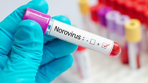 RSV, flu, COVID-19 and norovirus are on the rise in 2025. What to know
