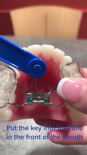 How to Turn Your Expander: Step-by-Step Guide