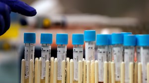 How to get tested for coronavirus at Walgreens in Houston