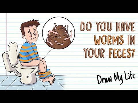 Intestinal worms treatment #health #viral #digestion