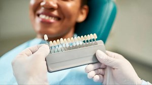 Considering Veneers? Here’s What You Should Know