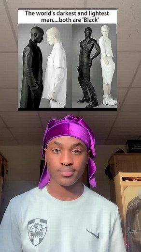 The Blackest and Whitest People in the World