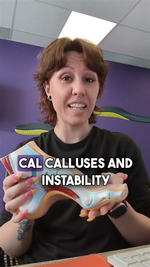 Do you have high arches?