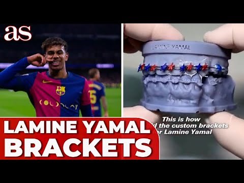 ASÍ se hicieron los BRACKETS especiales de LAMINE YAMAL para EL CLÁSICO