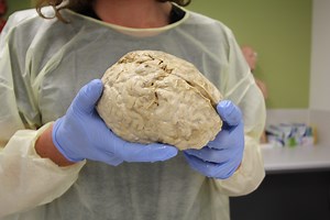 We Dissected a Brain to Understand What Happens When You Die