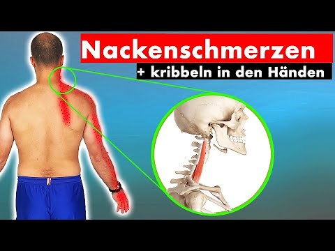 Cervical spine syndrome ► ► This muscle is to blame (DO NOT STRETCH!) | Cause & solution through ...