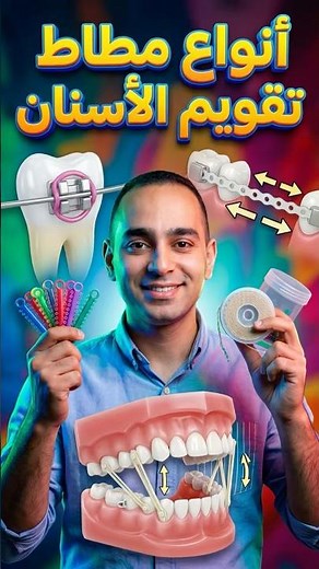 Types of orthodontic elastics and the differences between them 😎 When and why is each type used? ...