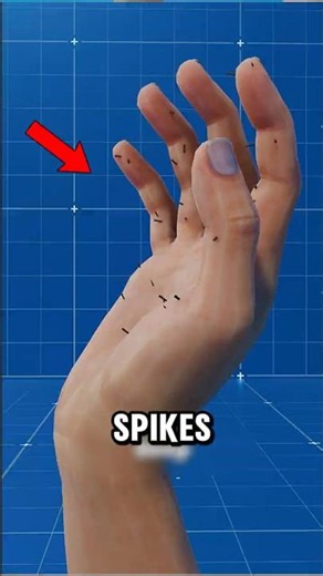 If You Ever Get a Splinter, NEVER Do This!