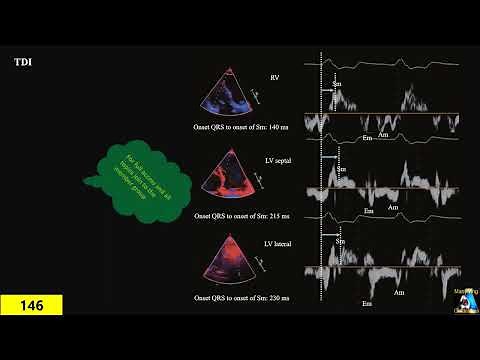 Cardiac Dyssynchrony