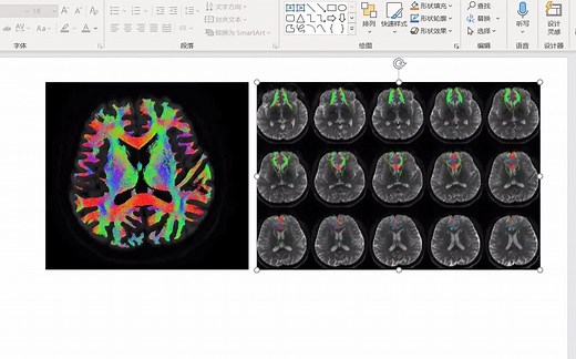 MRtrix3的MRview查看图像