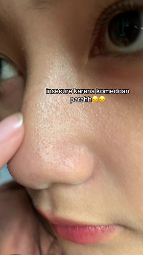 Glad2Glow Volcano Clay Stick Mask: Transformasi Kulit dan Penghilang Komedo