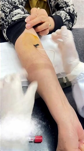 | Technique of Flying Niddle 😨 |