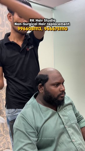 9K views · 416 reactions | Non-surgical hair replacement | RK Hair...