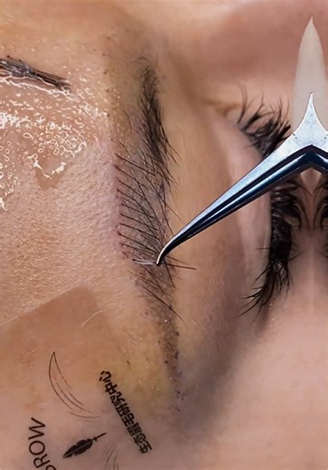 Eyebrow and Long Hair transplant🥰🥰🥰#eyebrowtransplantation #eyebrowtrimming #beauty #植眉 #眉毛种植 #眉毛種植 #truebeauty #trueeyebrow #hairtransplant #eyelashtransplant #пересадкабровей#beautyschool #eyebrowimplant #植髮 #植睫毛 #посадка #زرعالحواجب #makeup #eyebrow #eyebrowsonfleek #变美 #longhairtransplant #eyebrowtatoo #eyebrowgrowth #besteyebrowproduct #viraleyebrowhacks#permanenteyebrow\t#eyebrowshape #waterproofeyebrow#Chinatravel