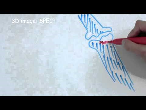 How does bone scintigraphy work?