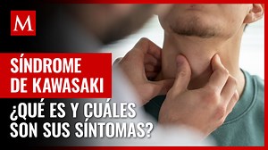 Enfermedad de Kawasaki: qués es y cuáles son sus síntomas