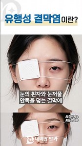 유행성 결막염이란?