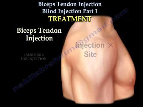 Biceps Tendon Injection. Blind Injection Part 1 - Everything You Need To Know - Dr. Nabil Ebraheim