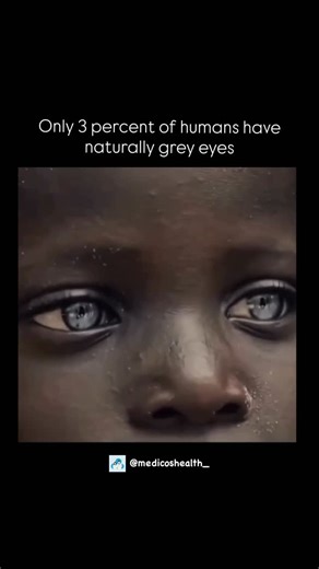 Medical & Health ⚕️ on Instagram: "Only about 3% of the world’s population has natural grey eyes because this color is a rare genetic variation resulting from a specific combination of very low melanin in the iris and a high concentration of collagen that causes a unique light-scattering effect. The color of the human eye is determined by the amount and distribution of the pigment melanin within the iris’s two layers, primarily the front layer known as the stroma, and the way light interacts wit