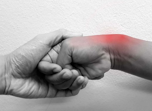 Tendinopatia de Quervain: causas, sintomas e tratamento - Clínica Dr. Hong Jin Pai - Dor, Fisiatria e Acupuntura Médica