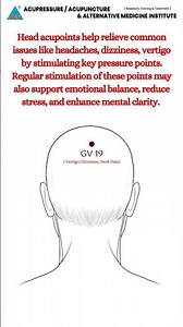 Head Acupoints for Headache, Dizziness & Stress Relief | Easy Acupressure for Instant Calm