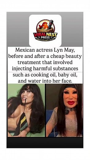 From Icon to Warning: The Heartbreaking Story of Lyn May