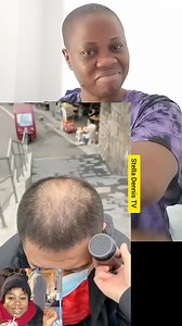 153K views · 562 reactions | Wow, this will help pe0ple that does not have hair in their h#ad so beautiful and amazing. | Stella Dennis tv | Facebook